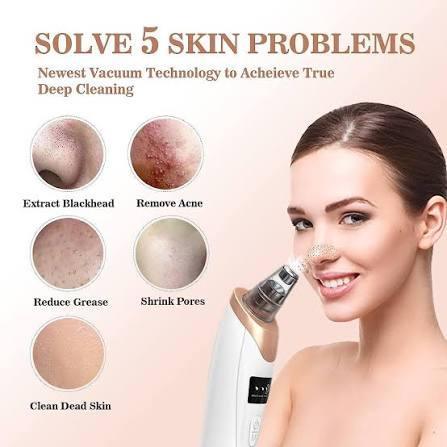 Electric Blackhead Remover Vacuum – Professional Pore Cleaner & Acne Needle Kit