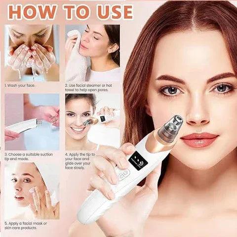 Electric Blackhead Remover Vacuum – Professional Pore Cleaner & Acne Needle Kit